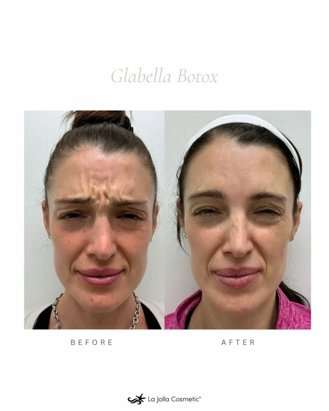 You know what never gets old? An amazing before and after! Justyne at our Temecula location does an amazing job at bringing her patients goals into a reality!⁠
⁠
Call our Temecula location today and get on Justynes books!