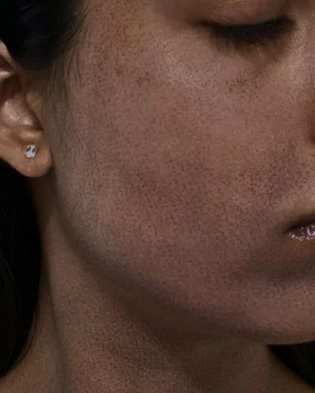 What are “MENDS” after MOXI? Let’s talk!⁠
⁠
MENDS = Microscopic Epidermal Necrotic Debris (aka tiny coffee-ground–like dots that appear as your skin renews).⁠
⁠
After your MOXI treatment, you can expect:⁠
• Light bronzing or sandpaper texture⁠
• MENDS to appear around days 2–4⁠
• Natural exfoliation over 5–7 days⁠
• Fresh, brighter, smoother skin underneath ✨⁠
⁠
This is a good thing—it means your skin is actively regenerating and collagen is waking up.⁠
⁠
Trust the process. Protect with SPF. Don’t pick.⁠
⁠
✨ Ready to glow smarter, not harsher? Book your MOXI consult today at one of our four locations in La Jolla, Temecula, Otay Ranch, or Carlsbad.