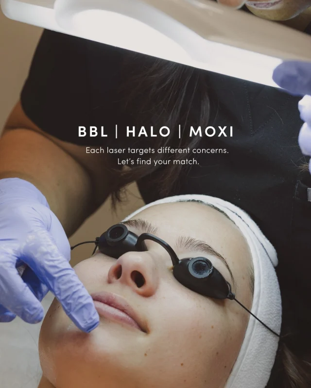 Sun damage. Texture. Early signs of aging.⁠
⁠
✨ There’s a laser for that. ✨⁠
⁠
BBL, Halo, and Moxi each target different skin concerns and work at different levels of the skin. Whether you’re looking to correct pigmentation, smooth texture, or maintain healthy, glowing skin, there’s a treatment designed for you.⁠
⁠
Not sure which one is right for you? That’s what consultations are for.⁠
⁠
Tap the link in bio to book!⁠