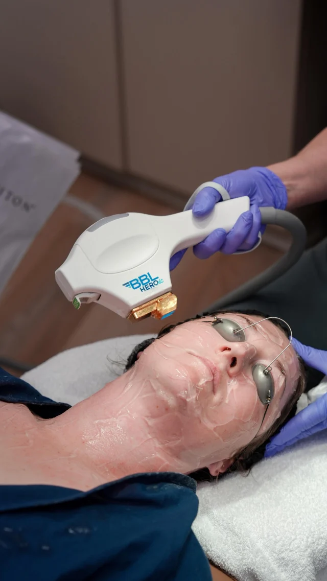 The right laser plan makes all the difference ✨

Andrea, PA-C shares how our consultation process is designed to understand your skin and thoughtfully select the right laser (or combination of lasers) to deliver real results. Because your skin deserves more than a one-size-fits-all approach.

Customized always.

Book your consultation at the link in bio! 🤍

.

[ San Diego Medspa, Best of San Diego, San Diego Aesthetician, Medspa, Skin Clinic, San Diego Injector, La Jolla Cosmetic Medical Spa, BBL Heroic, Sciton Laser Treatments, Before and After, Facials in San Diego, Medical Grade Skincare]