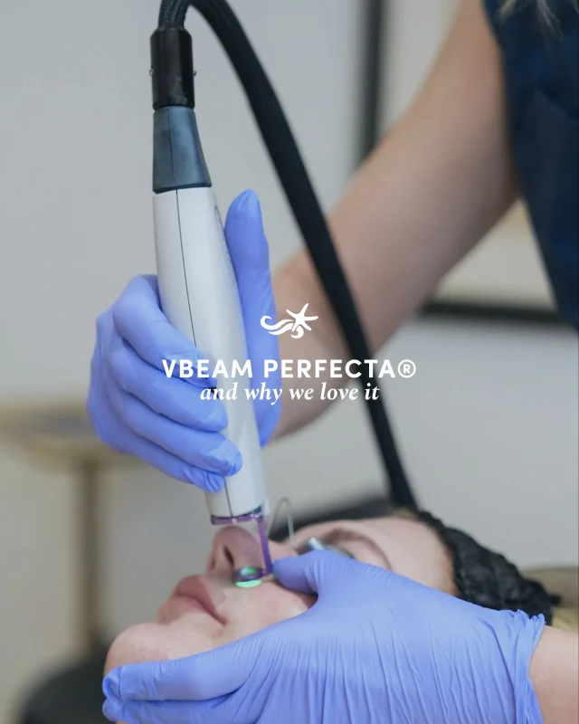 V-Beam, the laser we can’t get enough of, and neither can our patients.

Swipe to learn more about this laser and if it might be THE laser for you💫

.
[ San Diego Medspa, Best of San Diego, San Diego Aesthetician, Medspa, Skin Clinic, San Diego Injector, La Jolla Cosmetic Medical Spa, Anti Aging, Aesthetician, San Diego Facial, Skin Tips, V-Beam laser, Medical Grade Skincare]