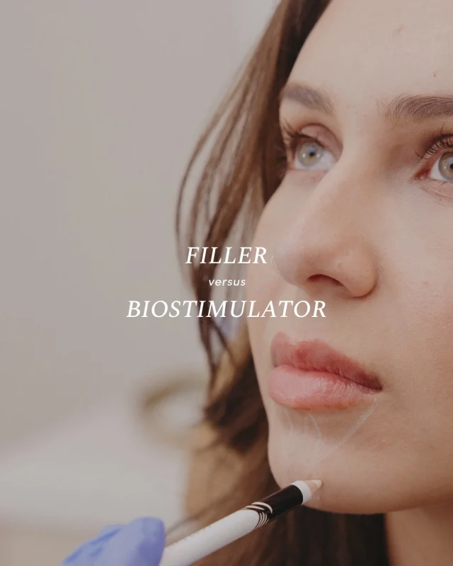 Filler vs. Biostimulators: what’s the difference? 👀✨ 
While both can enhance volume and rejuvenation, they work in completely different ways.

Swipe to learn which treatment may be right for your goals🤍

.

[ San Diego Medspa, Best of San Diego, San Diego Aesthetician, Medspa, Skin Clinic, San Diego Injector, La Jolla Cosmetic Medical Spa, Biostimulator, Collagen stimulator, Filler, Facial balancing, Aesthetic medicine, Natural results ]