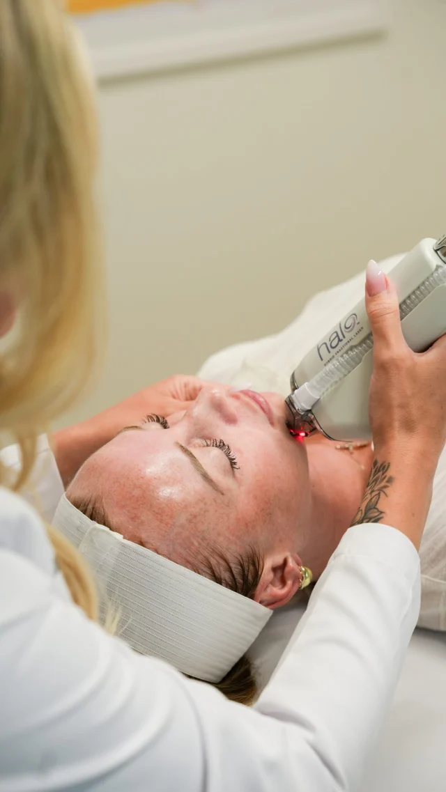 Your skin called and it wants a Halo Laser 👀✨

Why? Because Halo is one of the most effective treatments for improving overall skin quality. By targeting both the surface and deeper layers of the skin, it helps reduce the appearance of fine lines, sun damage, uneven tone, enlarged pores, and texture concerns while stimulating healthy collagen production.

Book your consultation via the link in bio and let us get you glowing!

.
[ San Diego Medspa, Best of San Diego, San Diego Aesthetician, Medspa, Skin Clinic, San Diego Injector, La Jolla Cosmetic Medical Spa, Skin resurfacing, Halo Laser, Sciton Laser, Sciton Laser Treatments, Preventive skincare ]